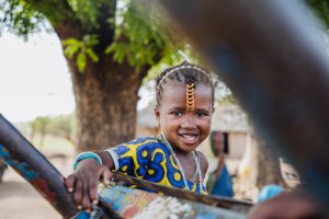 Sénégal&nbsp;: Une fillette de 4 ans capable de sourire pour la première fois après une intervention chirurgicale